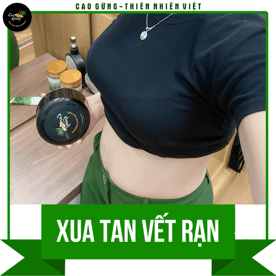 14329-cg165-4-9.png Cao Gừng Tan Mỡ Bụng Thiên Nhiên Việt 250g Phiên Bản 2025 - Tặng Cao Gừng Nghệ Đỏ - 8936079033002