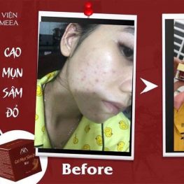Cao mụn Sâm Đỏ 36 Vị MeeA Organic loại 15g - 8938534672009