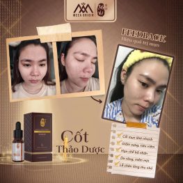 Serum Cốt Huyết Thanh Thảo Dược 36 Vị Full 10ml MeeA Origin - 893853467078