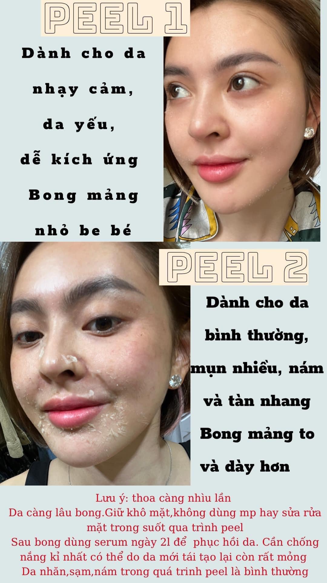 Peel Da Vi Tảo Retinol Số 1 Dành Cho Da Nhạy Cảm Trang Nemo Chính Hãng