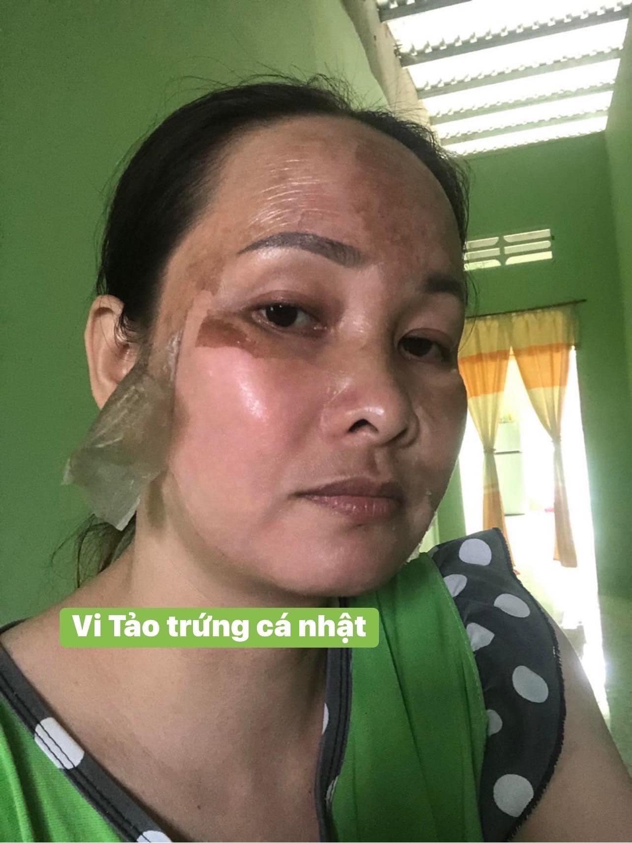 Vi tảo trứng cá nhật tái tạo Nicos chính hãng