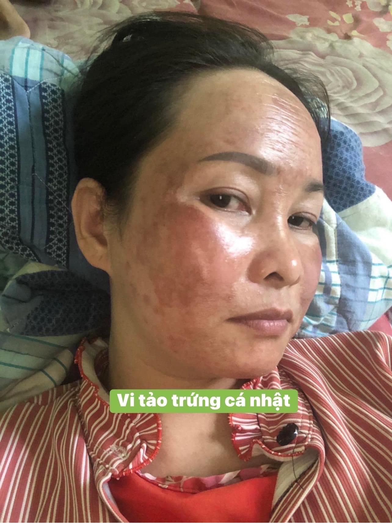 Vi tảo trứng cá nhật tái tạo Nicos chính hãng