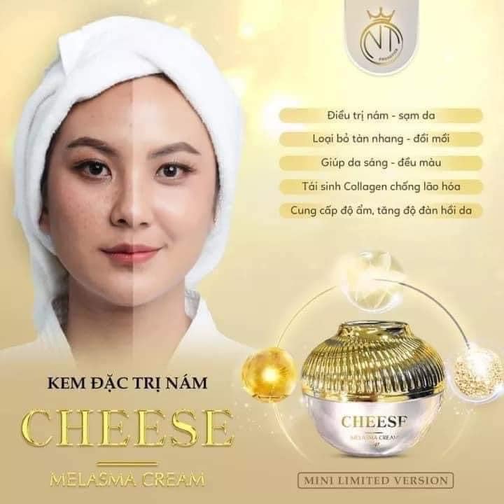 Kem Face Nám Melasma Cheese NT Cosmetics
