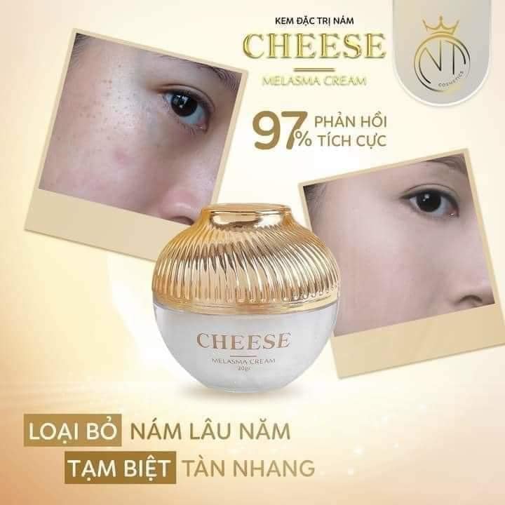 Kem Face Nám Melasma Cheese NT Cosmetics
