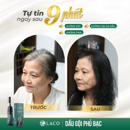Dầu Gội Phủ Bạc Laco Màu Đen - 8938515080687