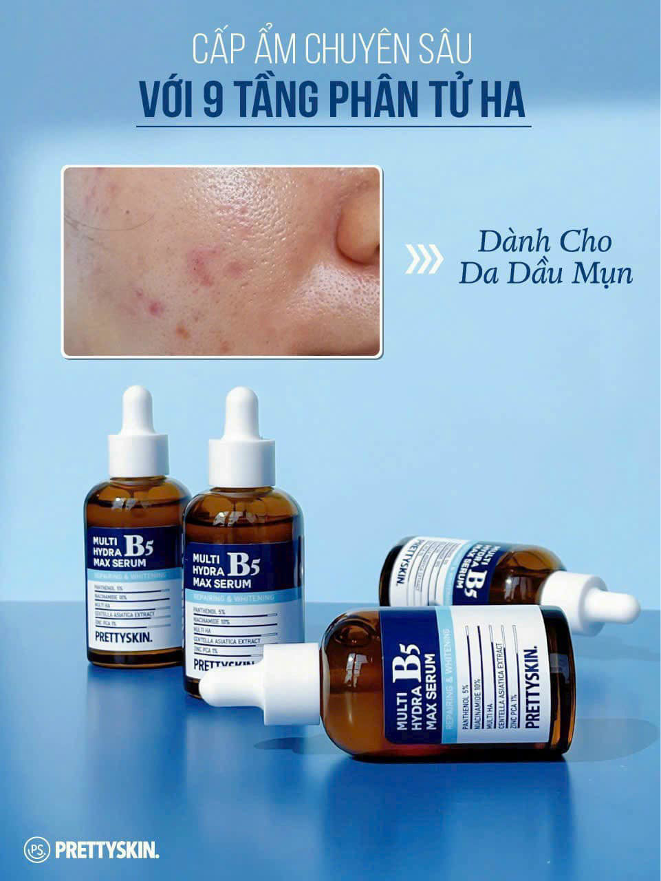 Kho sỉ serum B5 Prettyskin Multi Hydra Max Serum Cho Da Dầu Mụn 50ml