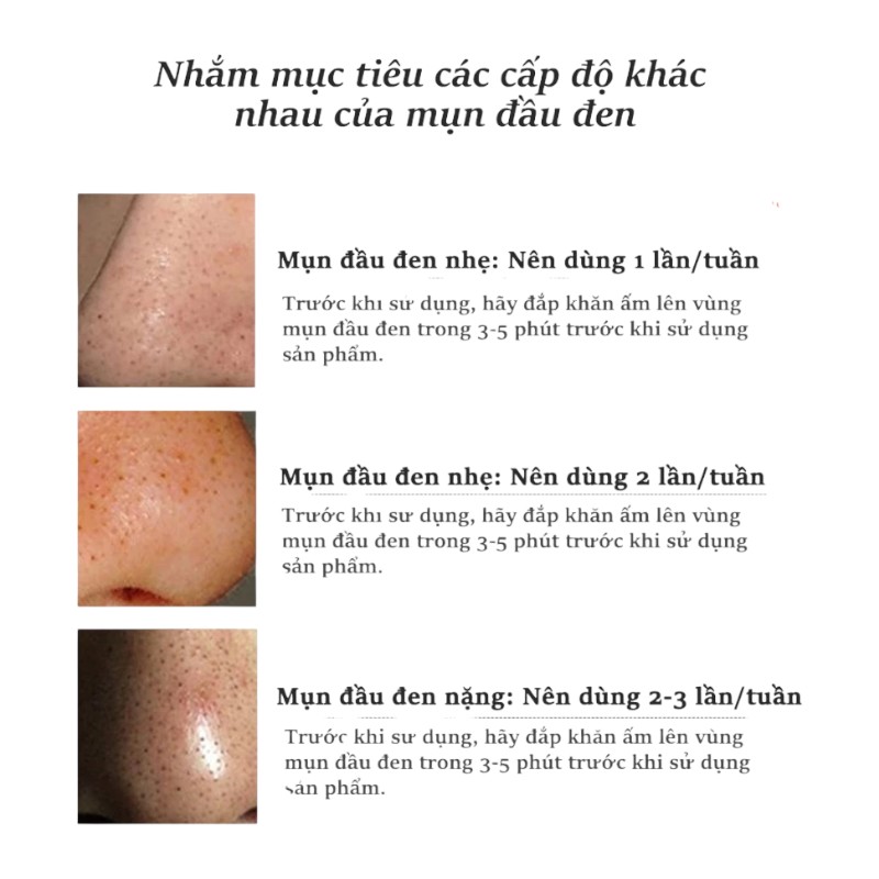 25404_okeshop-phu-photoroom_20241010143200-1.jpg Gel Lột Mụn Nha Đam Okeshop Acne Removal Gel 30g - GLMND