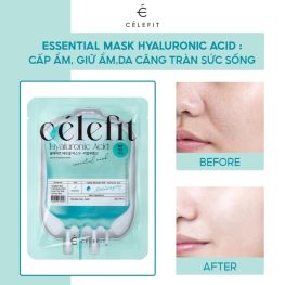 Mặt Nạ Cấp Ẩm Celefit Essential Mask Hyaluronic Acid 23g 10 Miếng - Dành Cho Da Khô Thiếu Ẩm