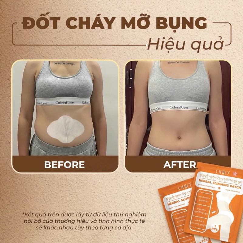 Kho sỉ miếng Dán Tan Mỡ Đông Y Tây Tạng Ohio Slimming Patch