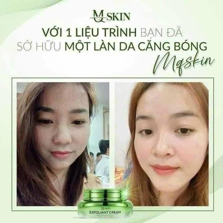 Kem Face Tái Tạo Nội Sinh Exfoliant Cream MQ Skin