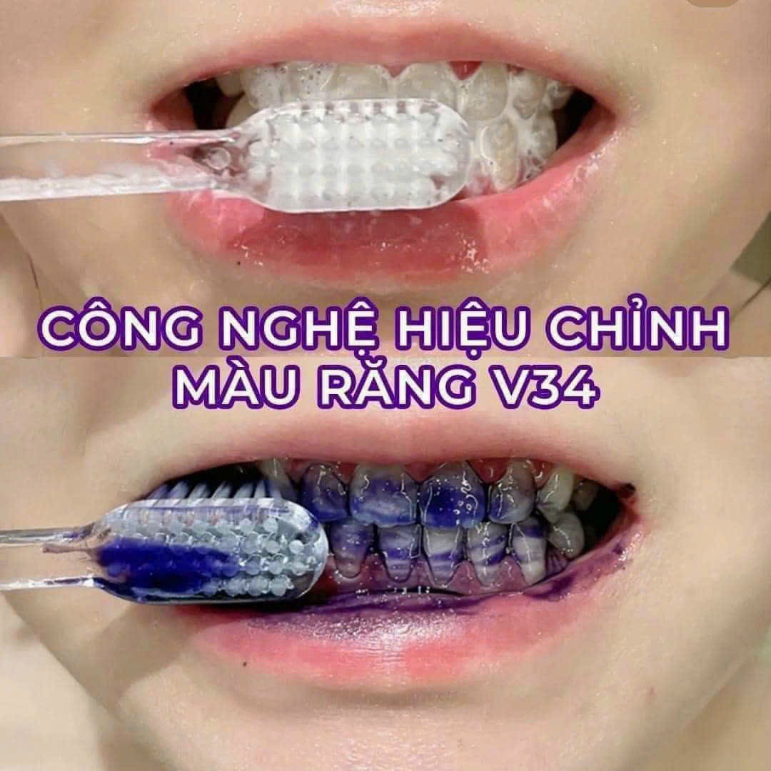 Serum Trắng Răng Unismile, Hỗ Trợ Cải Thiện Vết Ố Vàng Unikare