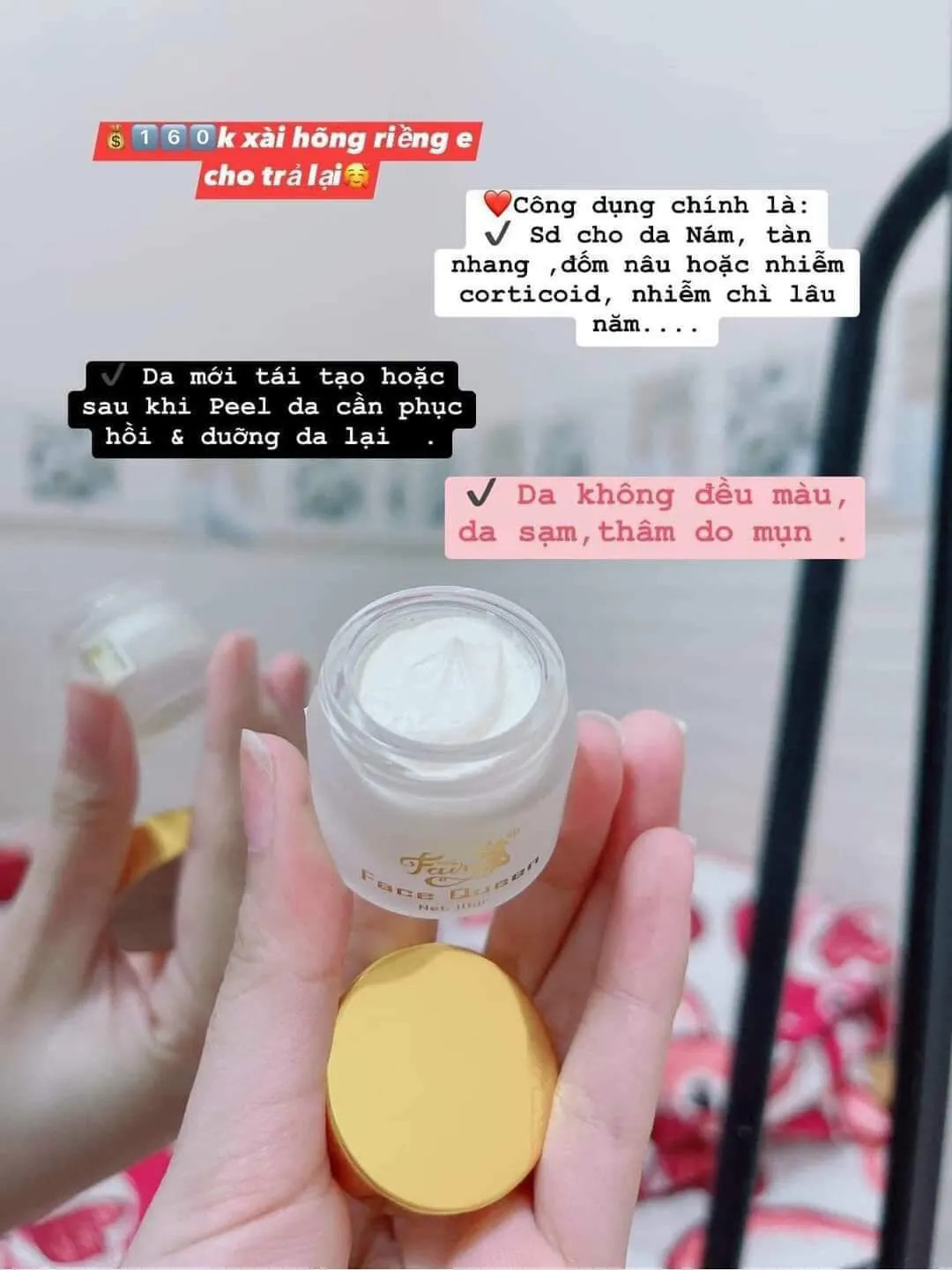 dưỡng trắng da ngừa mụn mờ thâm nám Fairy mini chính hãng Kem face Queen Fairy mini 10g