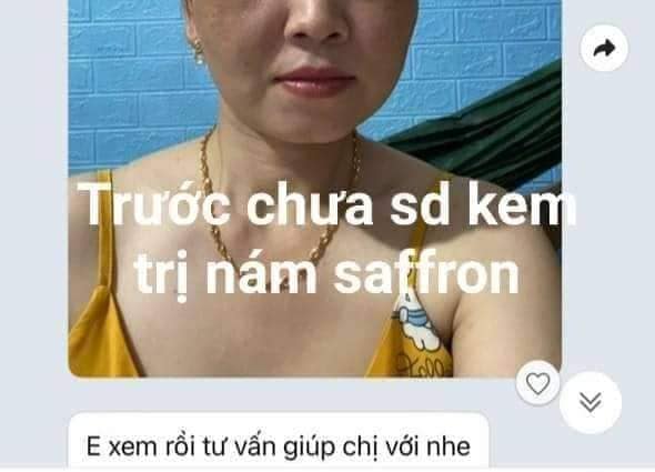 Feedback Kem Trị Nám Dưỡng Trắng Da Saffron Napoli Hải Âu Việt