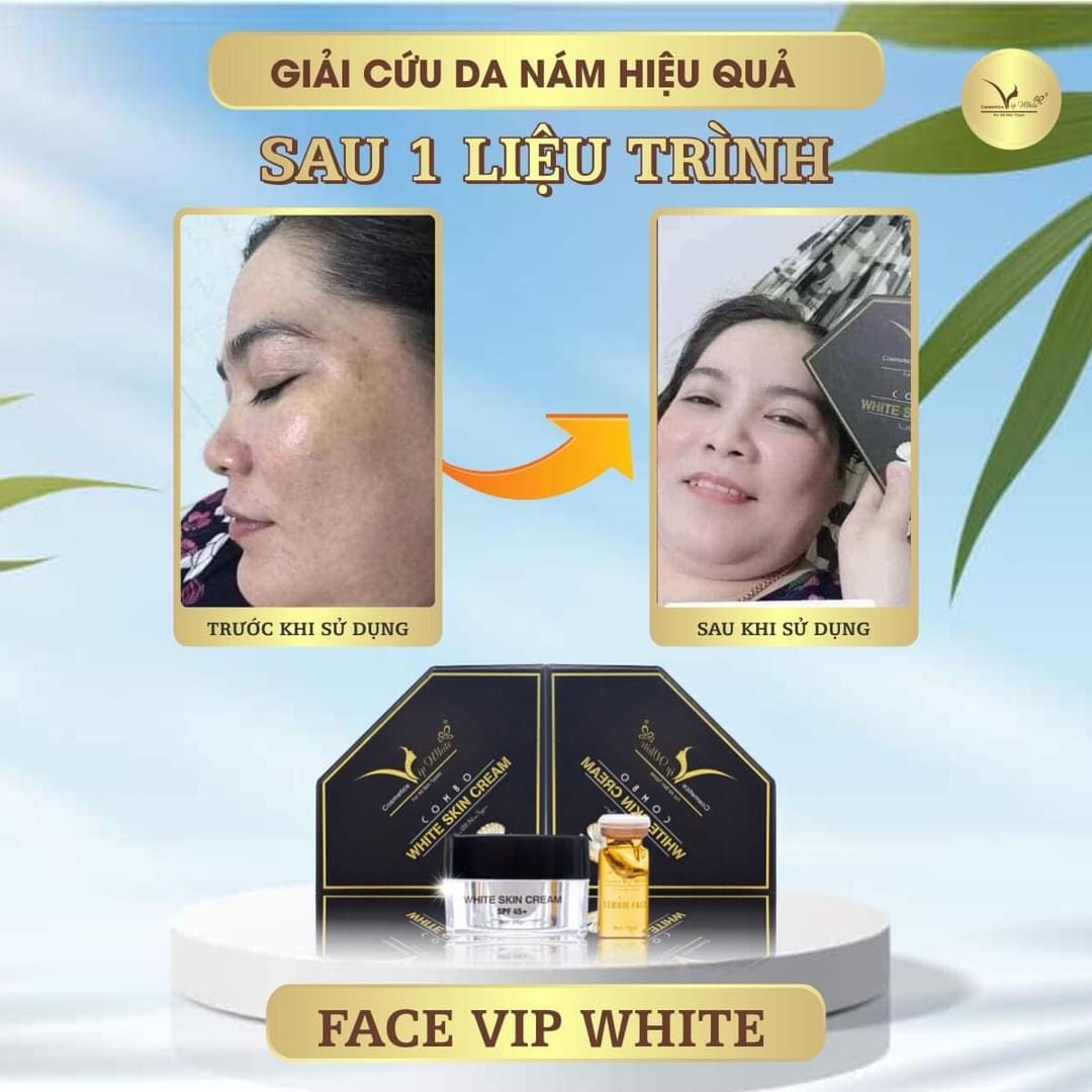 Kem Face Vip White Mang Làn Da Trắng Sáng Về Cho Bạn