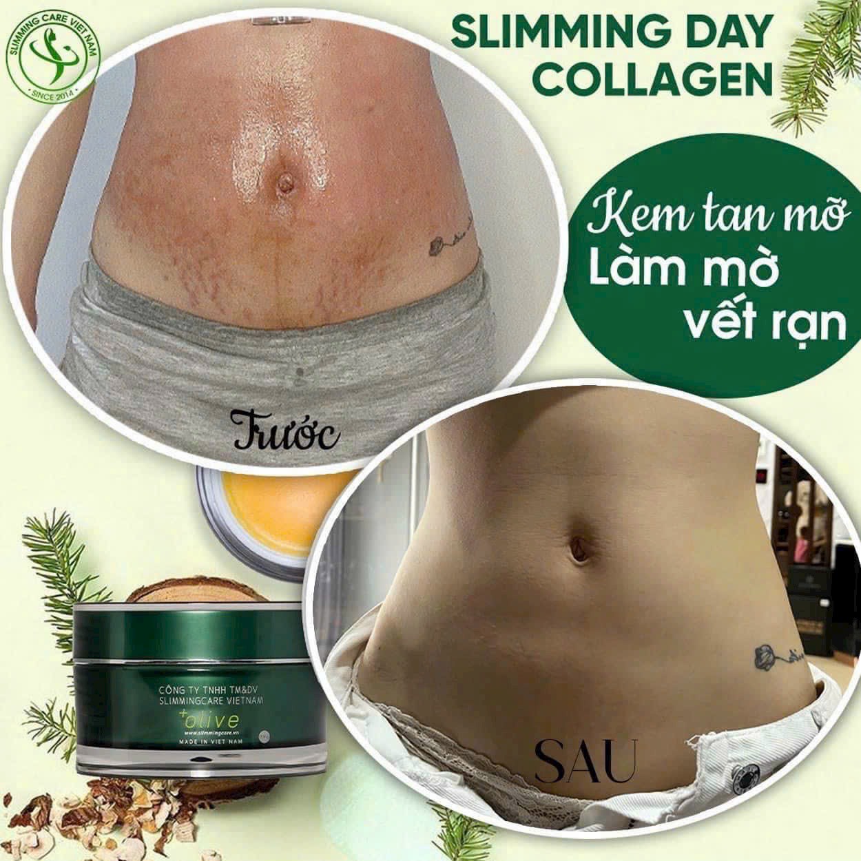 Bộ ủ nóng thải mỡ Slimming Body Sb2