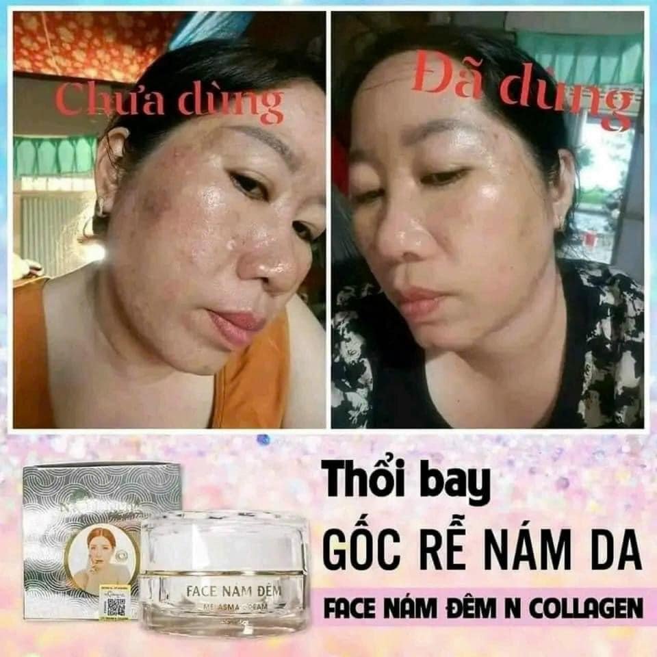 Chỉ với 1 lớp kem Face Nám Đem mỏng mịn trước khi đi ngủ là nàng có thể an tâm tìm lại làn da thanh xuân ngày nào